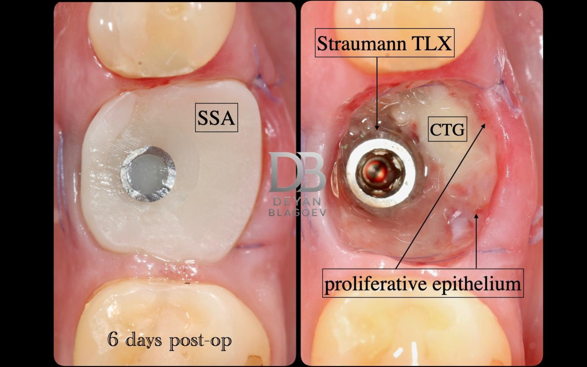 proliferative epithelium image